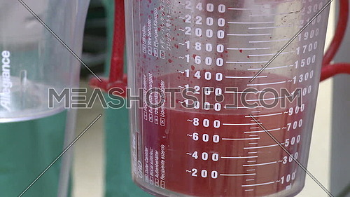 Close up shot for Equipment used to circulate blood