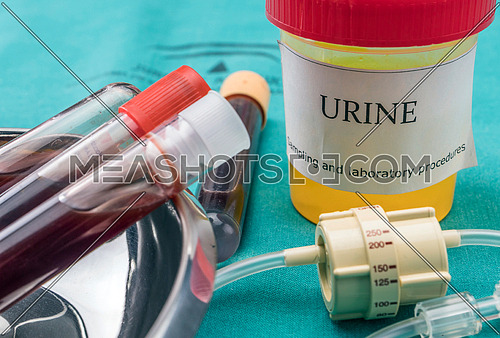 Urine and blood samples at a hospital table, conceptual image