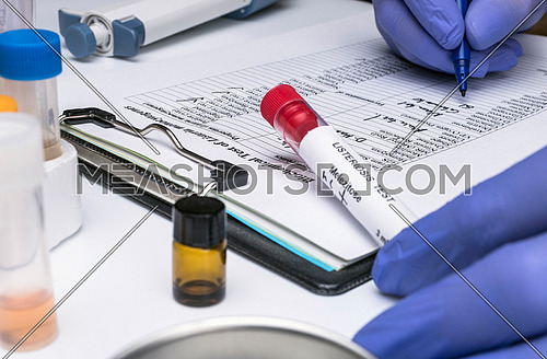 Scientist analyzes listeria sample in laboratory, conceptual image