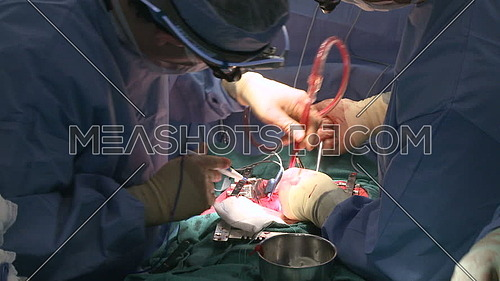medium shot for Surgeons using cell-salvage machine during open heart surgery