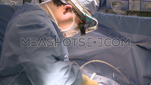 Close shot for a Surgeon uses electrocauterization tool to stop bleeding during surgery