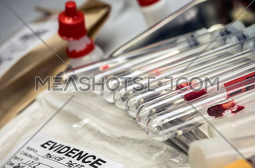 Different samples blood to analyze in the laboratory scientific, conceptual image
