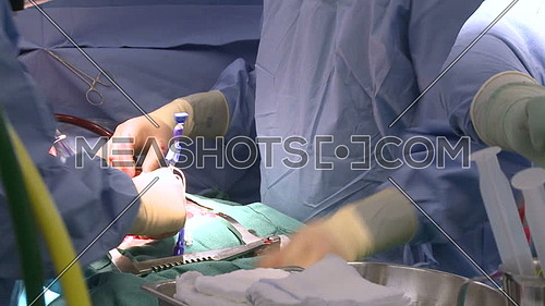 Medium shot for two Surgeons performing an open heart surgery in operating room