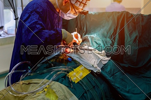 Surgeons team operating heart operating live shot