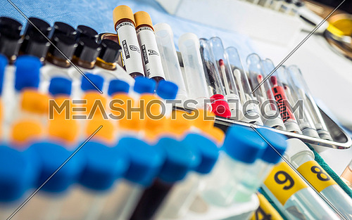 Different samples hair and blood to analyze in the laboratory scientific, conceptual image