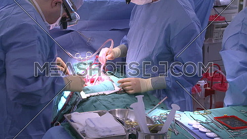 medium shot for medical team performing open heart surgery