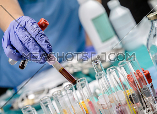 Doctor holds vial of blood sample in a hospital, conceptual image