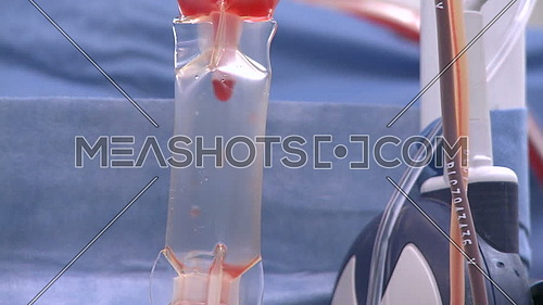 Close up shot for Blood drops into drip during surgery