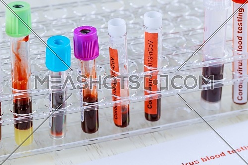 Coronavirus blood test 2019-nCoV,SARS-CoV, MERS-CoV chinese infection blood test in Laboratory