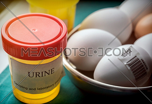 Urine samples and eggs in poor condition for examination in clinical laboratory, conceptual image