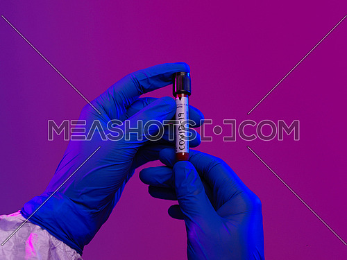 Coronavirus, Doctor holding positive covid-19 virus Blood Sample tube. Wearing biohazard epidemic Protective mask, suit and glows.