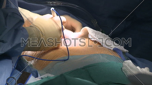 Close shot for a Doctor's hand makes first incision during Heart Surgery