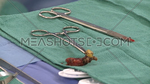 Close shot for a piece of cartilage within Surgical scissors on a surgical tray