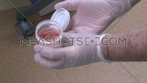 Close up shot for doctor hand holding a medical specimen