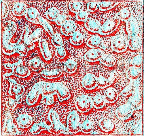 Confluent smallpox, vintage engraved illustration.
