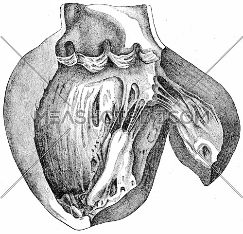 Heart with left ventricle laid open, showing the aortic cusps and the ventricular aspect of mitral valve, vintage engraved illustration.