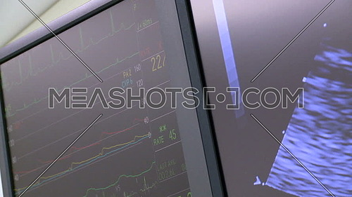 Close shot for Vital statistics monitor and Sonar Radiology monitor