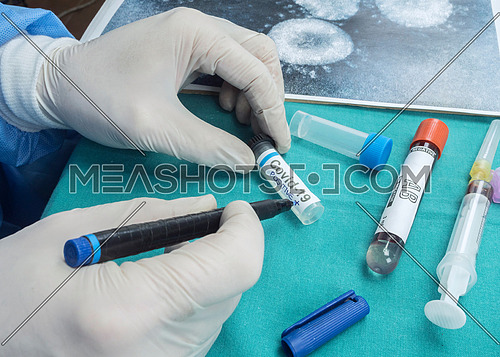 Nurse holds vial with positive result of a patient infected with covid19, conceptual image