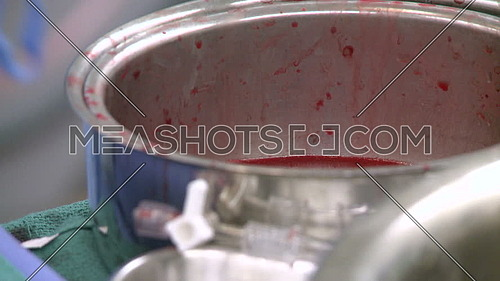 Close up shot for Surgical basin filled with blood 