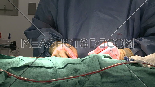 Side view of surgeon hand stitching patient