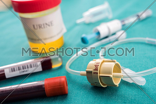 Dial flow next to a urine sample at a hospital table, conceptual image