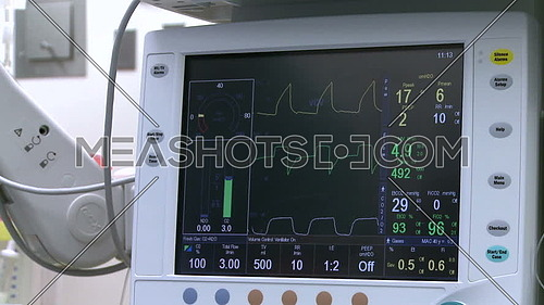 Close up shot for vital statics monitor during surgery