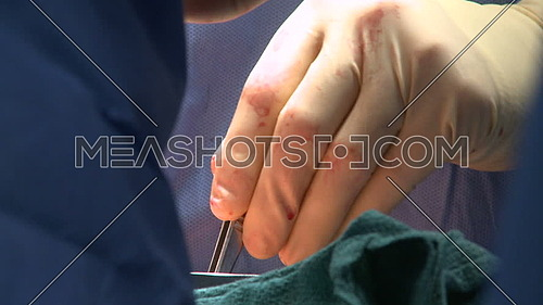 Close-up of surgeon's hands during operation