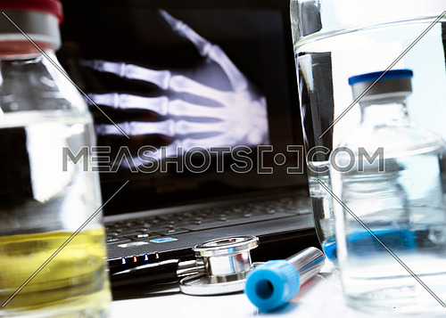 Hand radiography in hospital, conceptual image