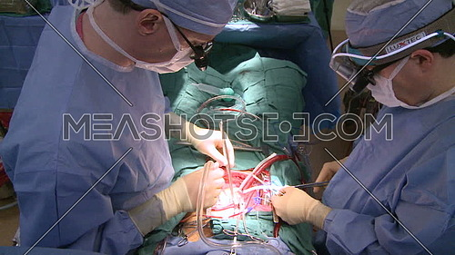 High angel long shot for two Surgeons work together on heart patient