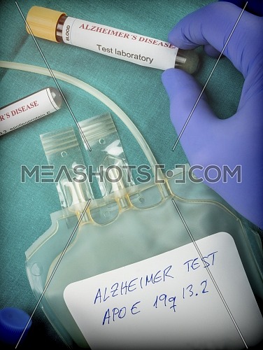 Scientist holds blood sample to investigate remedy against Alzheimer's disease, conceptual image