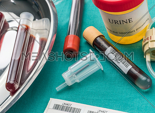 Urine and blood samples at a hospital table, conceptual image