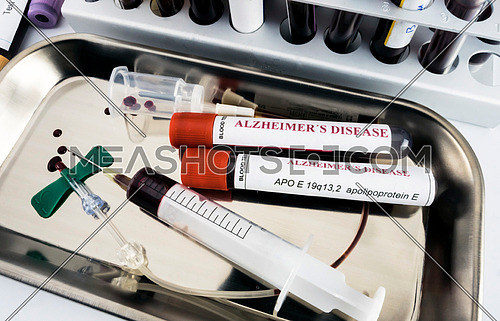 blood sample to investigate remedy against Alzheimer's disease, conceptual image