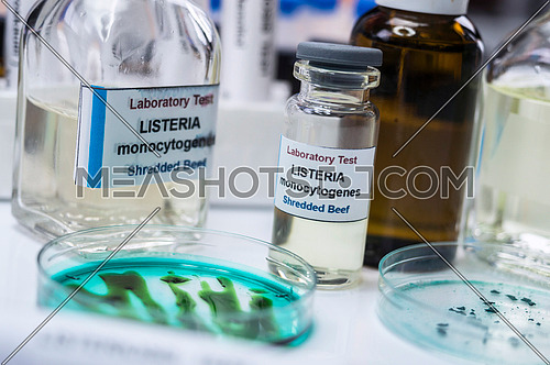 Samples you analyze of stuffed meat contaminated by bacterium of listeria in laboratory, sprout caused in Spain