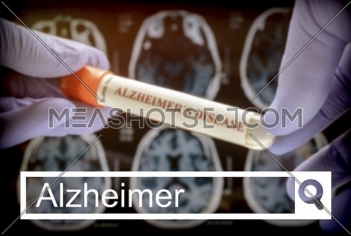 Search in the Alzheimer network, Scientist holds blood sample to investigate remedy against Alzheimer's disease, conceptual image