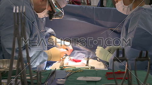 medium shot for operation room while nurse handing surgical instrument to doctor