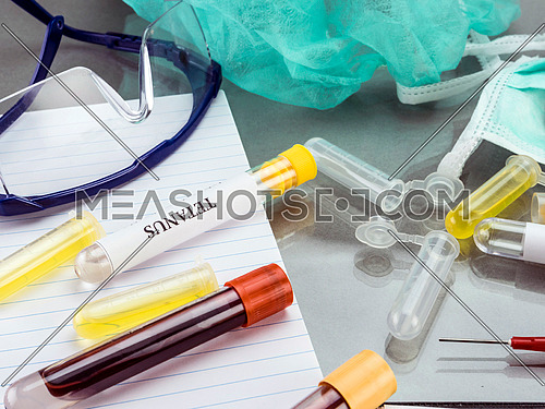 Some vials with samples of contagious diseases in a clinical laboratory