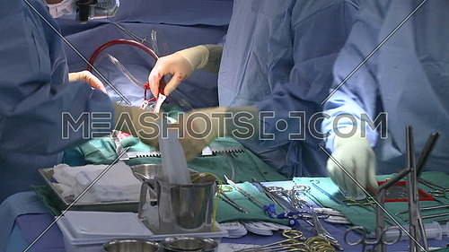 Close shot for nurse handing Medical instruments to doctor from surgical tray during heart surgery is performing in background