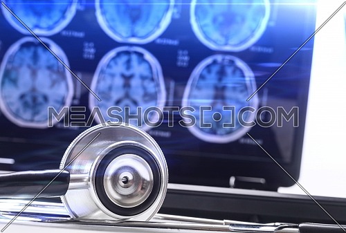 Stethoscope next to computer with X-rays of the brain, conceptual image