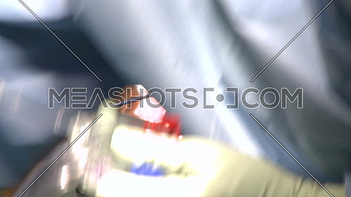 Close shot for doctors hand doing Cartilage removal during open heart surgery 